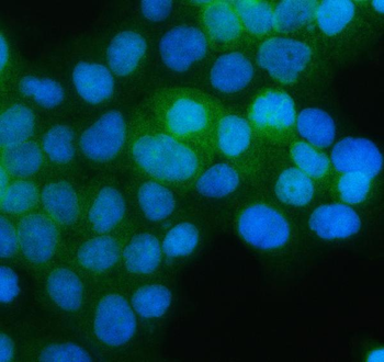 Anti-PGD Antibody