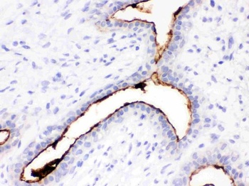 Episialin, EMA MUC1 Mouse Monoclonal Antibody