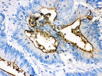Episialin, EMA MUC1 Mouse Monoclonal Antibody