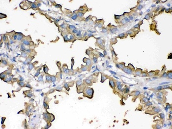 Episialin, EMA MUC1 Mouse Monoclonal Antibody