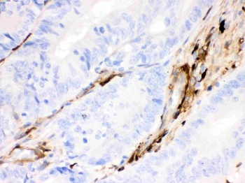 Anti-Gelsolin Gsn Antibody (Monoclonal, GS-2C4)