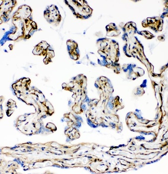 Laminin LAMA1 Monoclonal Antibody