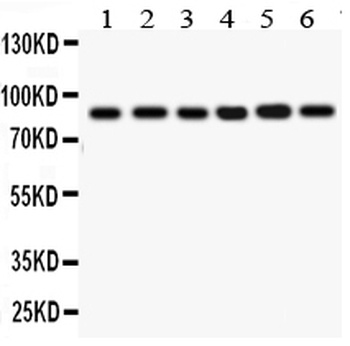 IKK beta/IKBKB Antibody