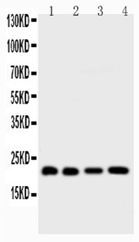 Anti-BID Antibody