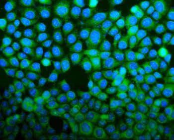 Anti-BID Antibody