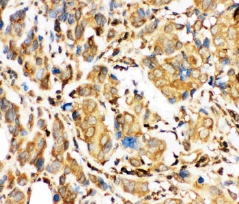 Anti-BID Antibody