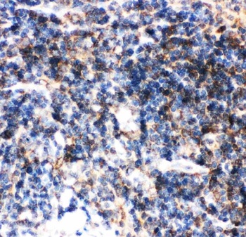 Anti-BID Antibody
