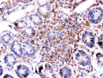 Anti-BID Antibody