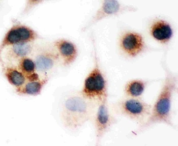 Anti-BID Antibody