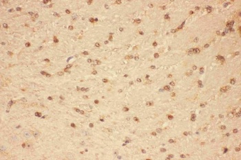 Anti-CNTF Antibody
