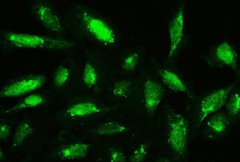 Cofilin/CFL1 Antibody