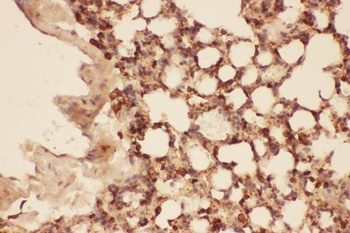 Anti-Cofilin/CFL1 Antibody