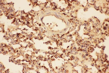 Anti-Cofilin/CFL1 Antibody