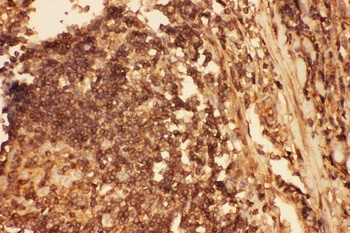 Anti-Cofilin/CFL1 Antibody