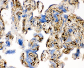 Anti-Cofilin/CFL1 Antibody