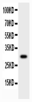 MMP7 Rabbit Polyclonal Antibody
