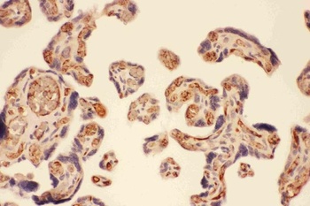 Anti-MMP7 Antibody