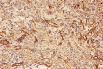 Anti-MMP7 Antibody