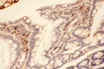 Anti-MMP7 Antibody