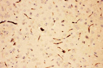Anti-ACTH/POMC Antibody