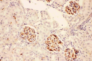Anti-ACTH/POMC Antibody