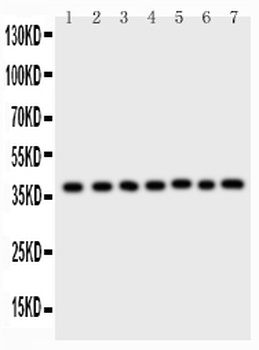 Anti-ARA9/AIP Antibody