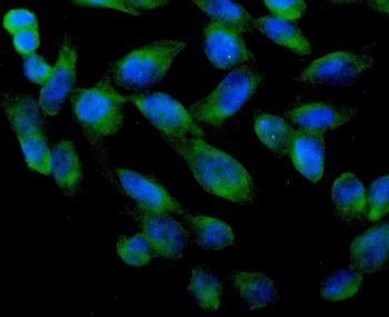 Anti-ARA9/AIP Antibody