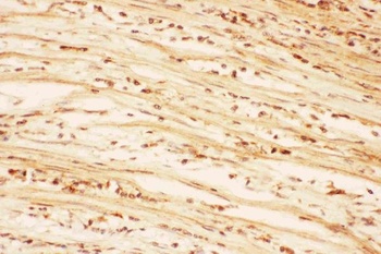 Anti-AKT2 Antibody