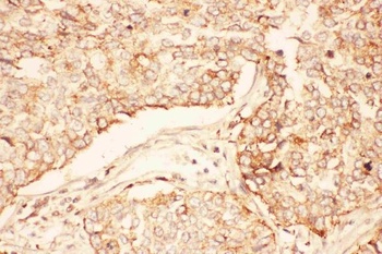Anti-AKT2 Antibody