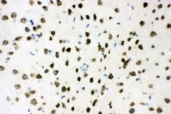 Anti-AKT2 Antibody