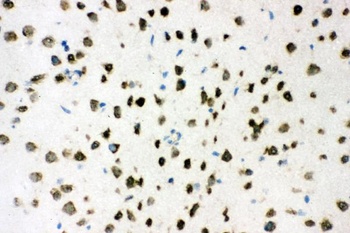 AKT2 Antibody