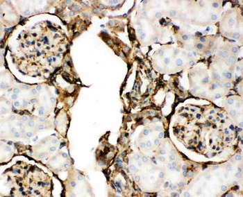 Anti-Annexin V/ANXA5 Antibody