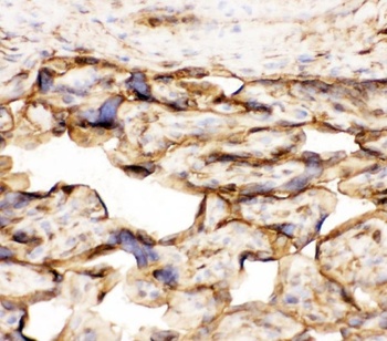 Anti-Annexin V/ANXA5 Antibody