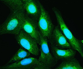 Anti-Annexin V/ANXA5 Antibody