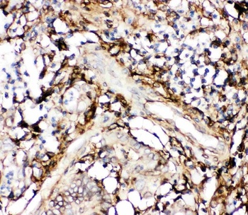 Anti-Annexin V/ANXA5 Antibody