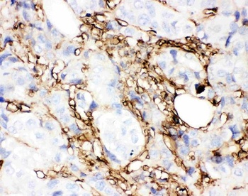Anti-Annexin V/ANXA5 Antibody