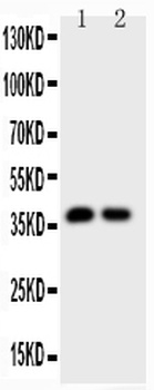 Anti-Calbindin/CALB1 Antibody
