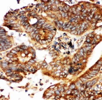 Anti-Calbindin/CALB1 Antibody