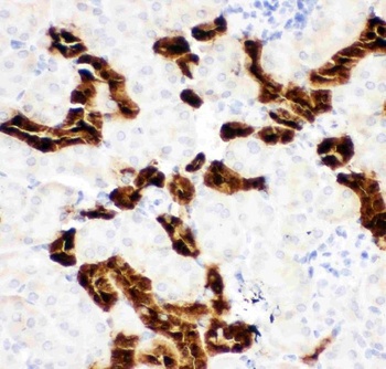 Anti-Calbindin/CALB1 Antibody