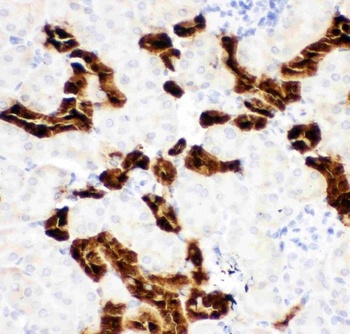 Calbindin/CALB1 Antibody