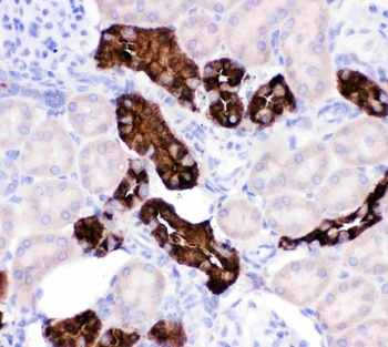 Anti-Calbindin/CALB1 Antibody