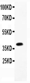 Cathepsin D/CTSD Antibody