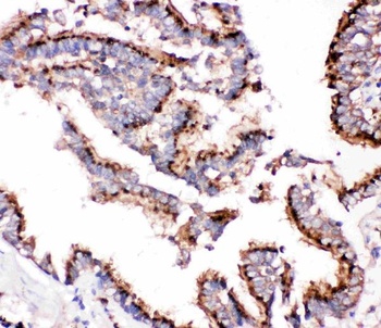 Anti-Cathepsin D/CTSD Antibody