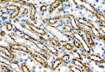 Cathepsin D/CTSD Antibody