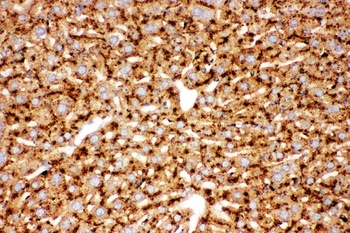 Cathepsin D/CTSD Antibody