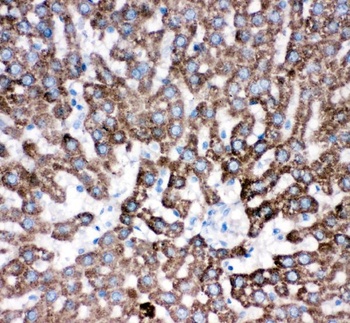 Cathepsin D/CTSD Antibody