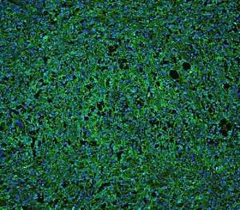Anti-CD20/MS4A1 Antibody