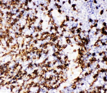 Anti-CD20/MS4A1 Antibody
