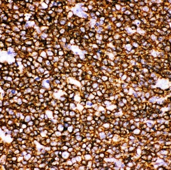 Anti-CD20/MS4A1 Antibody