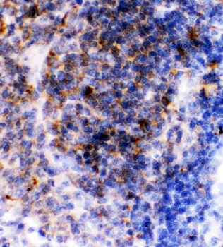 Anti-CD23/FCER2 Antibody